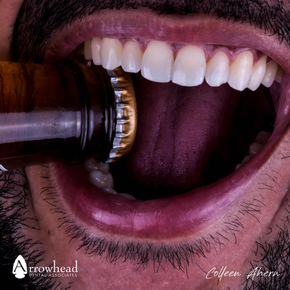 Does Alcohol Affect Teeth?