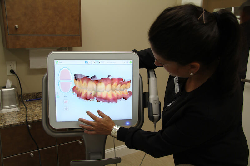 iTero®  Scanner in South County, RI