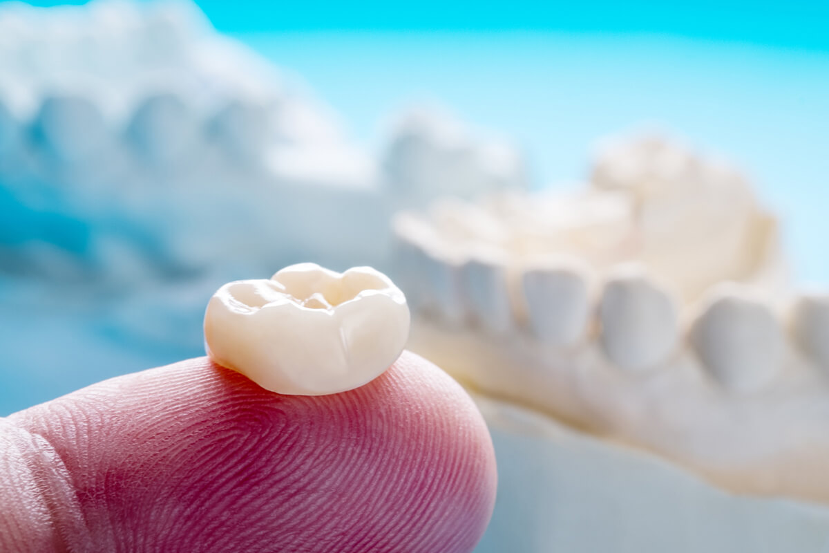 What if There is Not Enough Tooth for a Crown? Arrowhead Dental